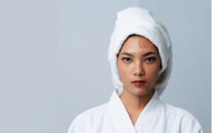 Làm sao hết thâm mụn? Những cách trị thâm mụn hiệu quả