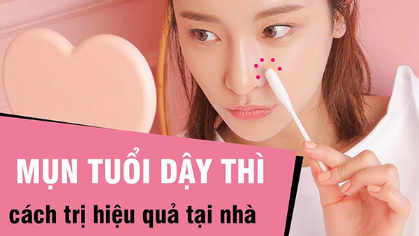 Ghim nhanh top 4 serum trị mụn cho tuổi dậy thì tốt nhất da lên đời ngay - Mỹ Phẩm Caryophy Việt Nam