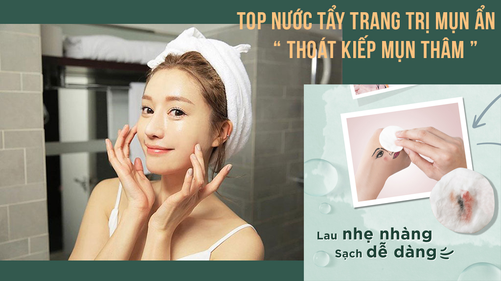 Cách sử dụng nước tẩy trang cho da mụn ẩn đúng cách là gì?
