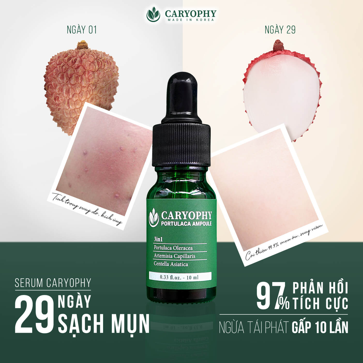 caryophy serum
